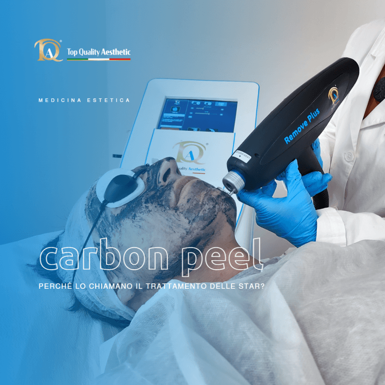 Carbon Peel